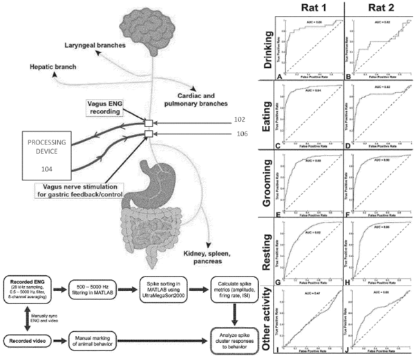 Case Western researchers use closedloop vagus nerve stimulation to